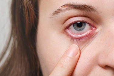 איך לשמור על העיניים שלכם נקיות ובריאות?